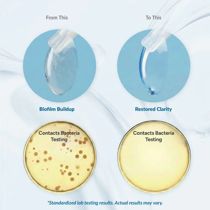 SoniClear PRO™ - Ultrasonic Contact Lens Cleaner